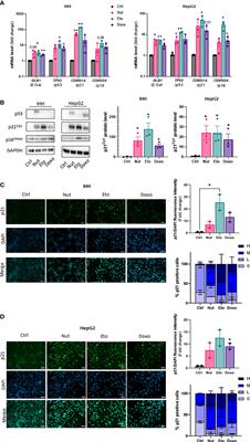 Cellular senescence in hepatocytes contributes to metabolic disturbances in NASH